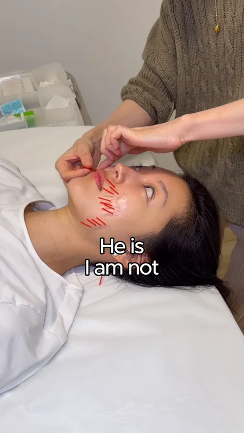Yeaji during a facial acupuncture session at GlazeAcu